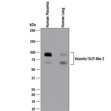 Detection of Human Vasorin/SLIT-like 2 antibody by Western Blot.