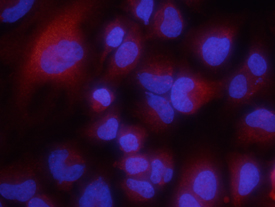 Versican antibody in HeLa Human Cell Line by Immunocytochemistry (ICC).