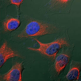 Vimentin antibody in HeLa Human Cell Line by Immunocytochemistry (ICC).