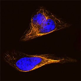 Vimentin antibody in HeLa Human Cell Line by Immunocytochemistry (ICC).