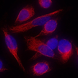 Vimentin antibody in HeLa Human Cell Line by Immunocytochemistry (ICC).