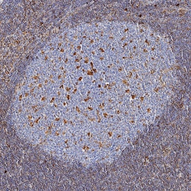 Vimentin antibody in Human Lymph Node by Immunohistochemistry (IHC-P).