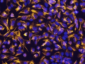 Vimentin antibody in NTera-2 Human Cell Line by Immunocytochemistry (ICC).