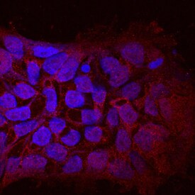 WTX antibody in BG01V Human Embryonic Stem Cells by Immunocytochemistry (ICC).