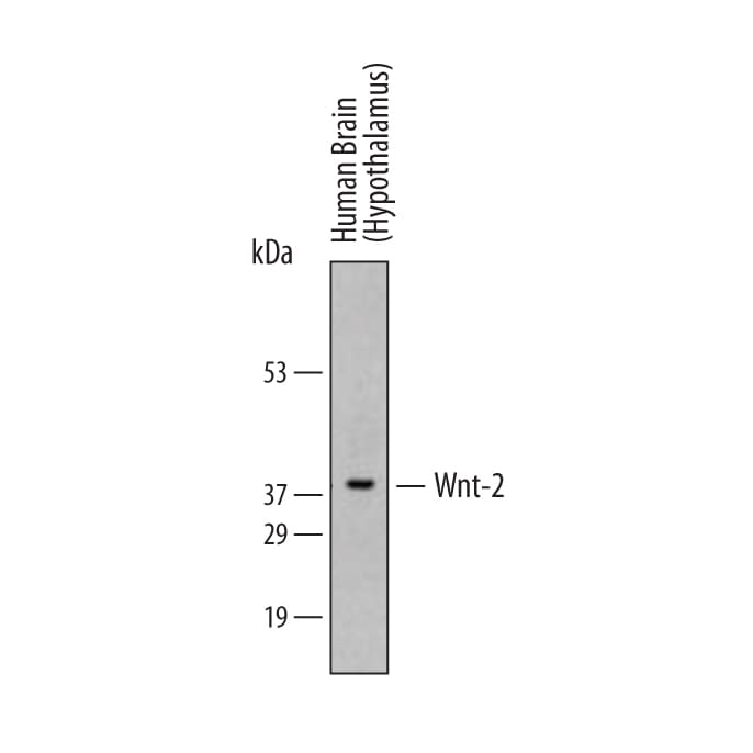 Detection of Human Wnt-2 antibody by Western Blot.