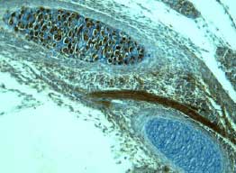 Wnt‑5a antibody in Mouse Embryonic Rib by Immunohistochemistry (IHC-P).
