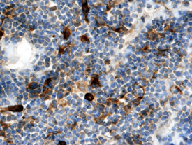 XCL1/Lymphotactin antibody in Mouse Thymus by Immunohistochemistry (IHC-Fr).