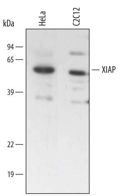 Detection of Human and Mouse XIAP antibody by Western Blot.