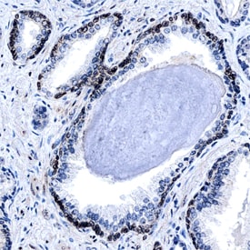 YAP1 antibody in Human Prostate by Immunohistochemistry (IHC-P).