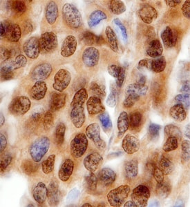 YY1 antibody in Human Breast by Immunohistochemistry (IHC-P).