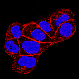 Yes antibody in A431 Human Cell Line by Immunocytochemistry (ICC).