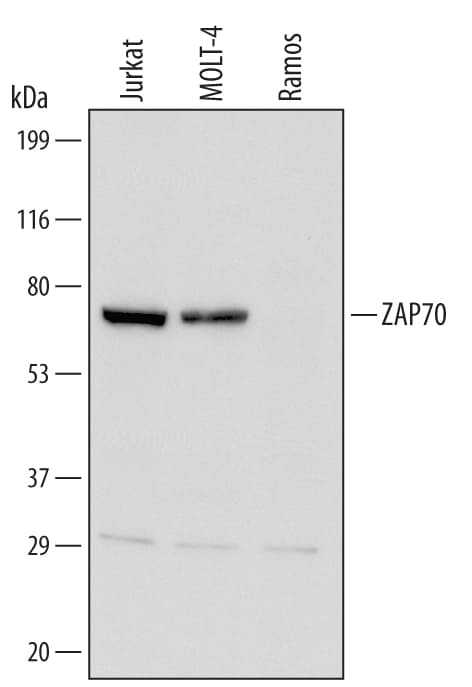Detection of Human ZAP70 antibody by Western Blot.