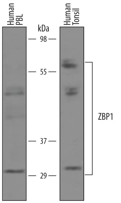 Detection of Human ZBP1/DLM-1/DAI antibody by Western Blot.