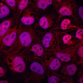 ZIC1 antibody in Human iPSK3 cells by Immunocytochemistry (ICC).