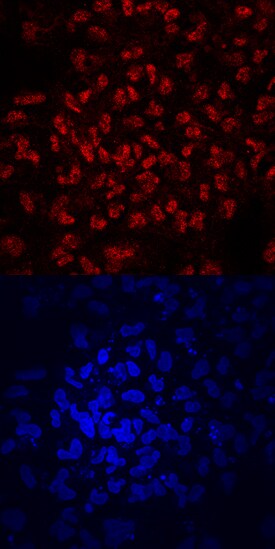 ZNF143 antibody in BG01V Human Stem Cells by Immunocytochemistry (ICC).