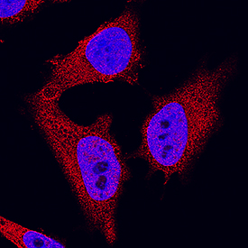 Zyxin antibody in A549 Human Cell Line by Immunocytochemistry (ICC).
