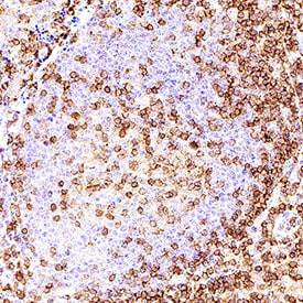 CD4 antibody in Human Tonsil Tissue by Immunohistochemistry (IHC-P).