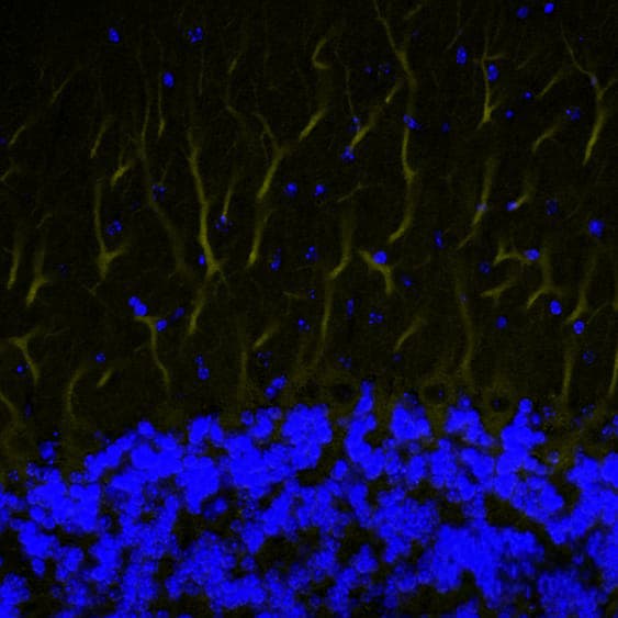 Human/Mouse/Rat Phospho-ERK1(T202/Y204)/ERK2 (T185/Y187) Antibody