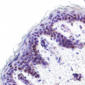 Detection of Pax3/Pax7 in Human Skin.