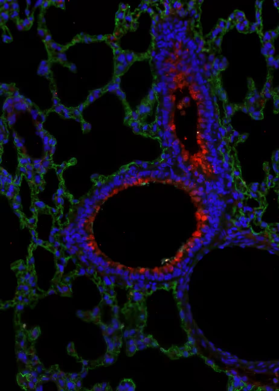 UGRP1/SCGB3A2 in rat lung tissue.