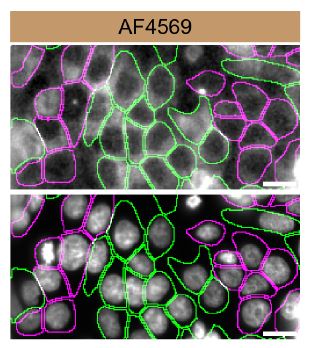 Casein Kinase 1 alpha Specificity is Shown by Immunocytochemistry in Knockdown Cell Line.