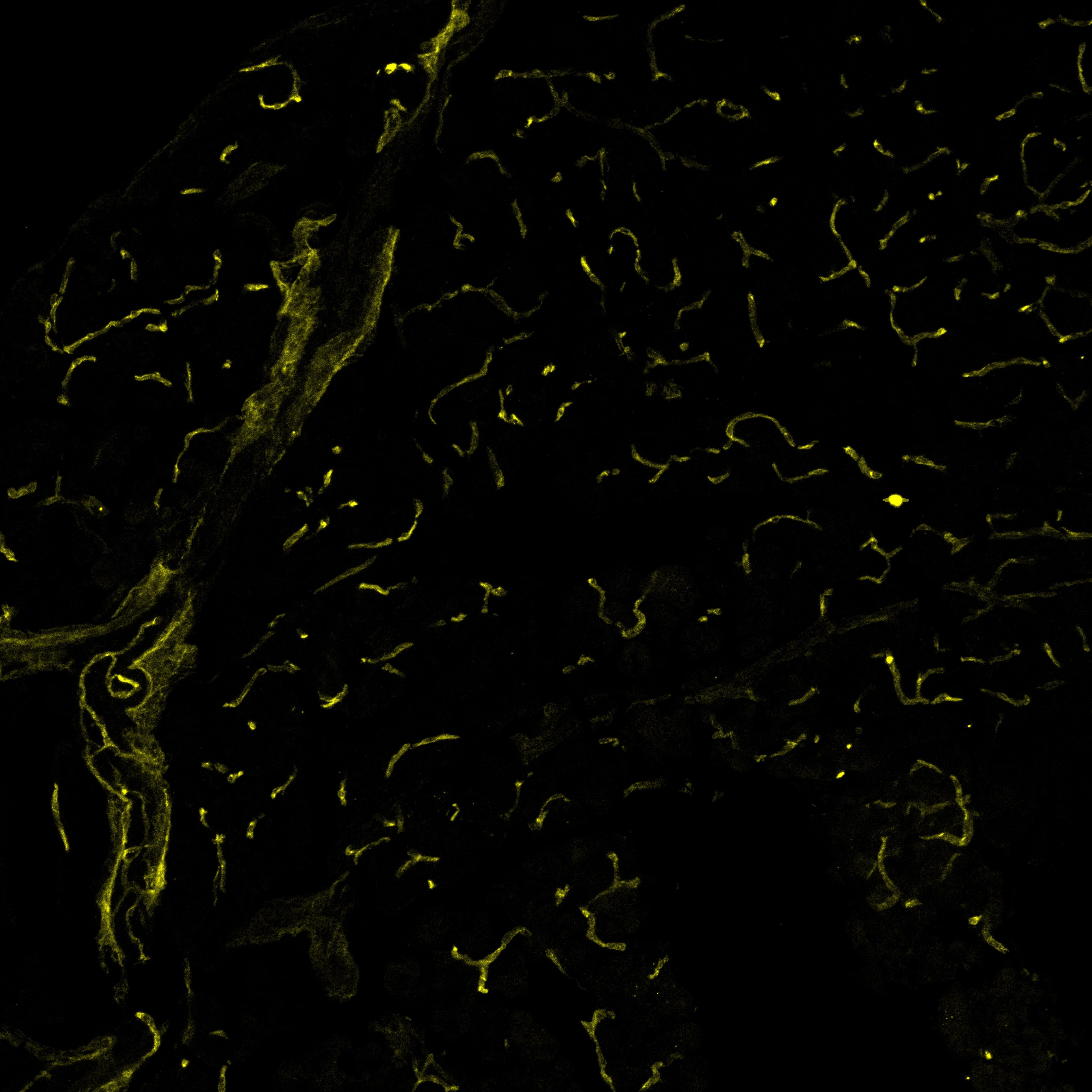VEGFR2/KDR/Flk‑1 in Mouse Pancreas.