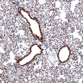 ACE‑2 antibody in Hamster Lung by Immunohistochemistry (IHC-P).