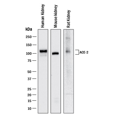 Detection of Human, Mouse, and Rat ACE‑2 antibody by Western Blot.