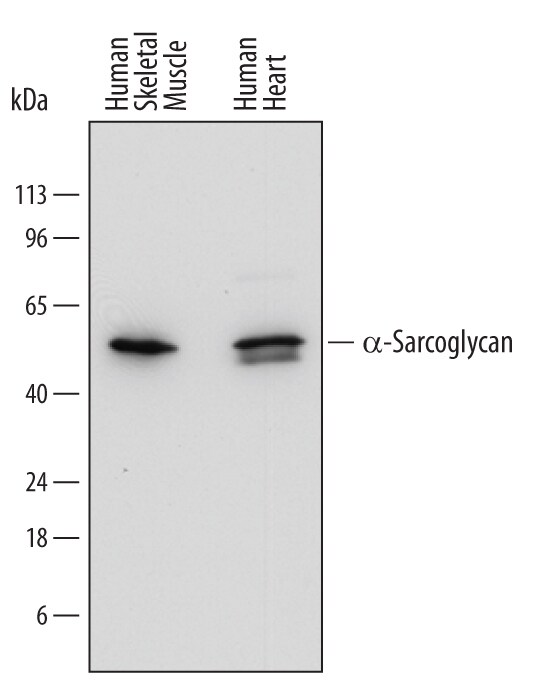 Detection of Human a-Sarcoglycan antibody by Western Blot.