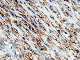 a-Smooth Muscle Actin antibody in Human Breast Cancer Tissue by Immunohistochemistry (IHC-P).