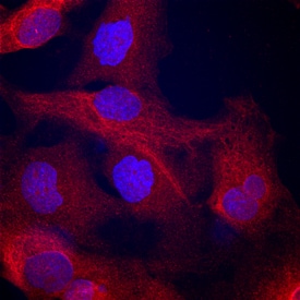 a-Actinin 1 antibody in A172 Human Cell Line by Immunocytochemistry (ICC).