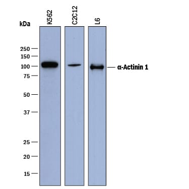 Detection of Human, Mouse, and Rat a-Actinin 1 antibody by Western Blot.