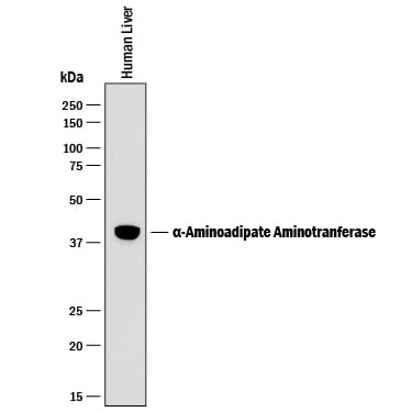 Detection of Human a-Aminoadipate Aminotransferase antibody by Western Blot.