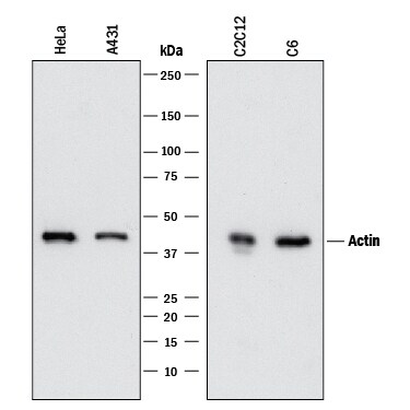 Detection of Human, Mouse, and Rat a-Cardiac Actin antibody by Western Blot.
