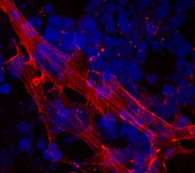 a-Cardiac Actin antibody in Human Cardiomyocytes by Immunocytochemistry (ICC).