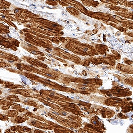 a-Cardiac Actin antibody in Human Heart by Immunohistochemistry (IHC-P).