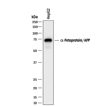 Detection of a-Fetoprotein/AFP antibody by Western Blot.