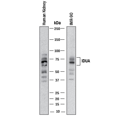 Detection of Human a-L-Iduronidase/IDUA antibody by Western Blot.