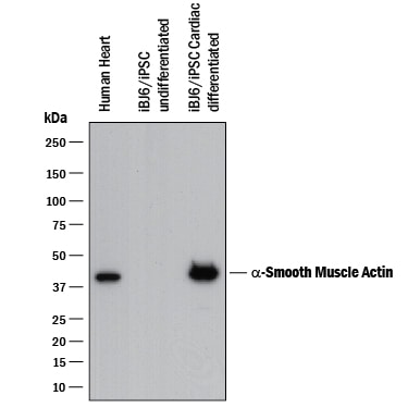 Detection of Human a-Smooth Muscle Actin antibody by Western Blot.