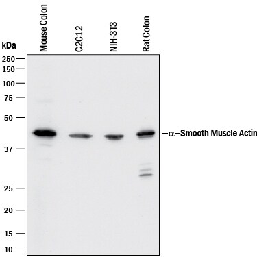 Detection of Mouse and Rat a-Smooth Muscle Actin antibody by Western Blot.