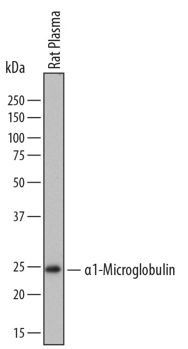 Detection of Rat a1-Microglobulin antibody by Western Blot.