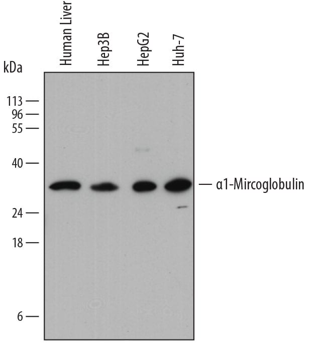 Detection of Human a1-Microglobulin antibody by Western Blot.