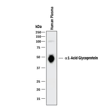 Detection of Human a1‑Acid Glycoprotein antibody by Western Blot.