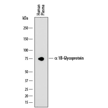 Detection of Human a 1B-Glycoprotein antibody by Western Blot.