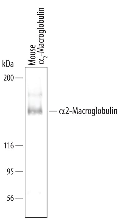 Detection of Mouse a2-Macroglobulin antibody by Western Blot.