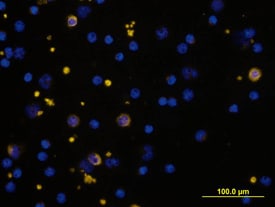 a2-Macroglobulin antibody in Human PBMCs by Immunocytochemistry (ICC).