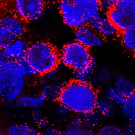 a2-Macroglobulin antibody in human PBMCs by Immunocytochemistry (ICC).