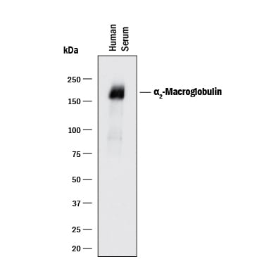 Detection of Human a2-Macroglobulin antibody by Western Blot.