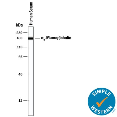 Detection of Human a2-Macroglobulin antibody by Simple WesternTM.