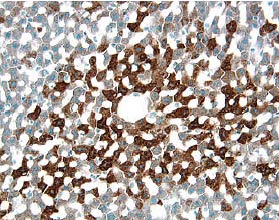 a2u-Globulin antibody in Rat Liver by Immunohistochemistry (IHC-Fr).